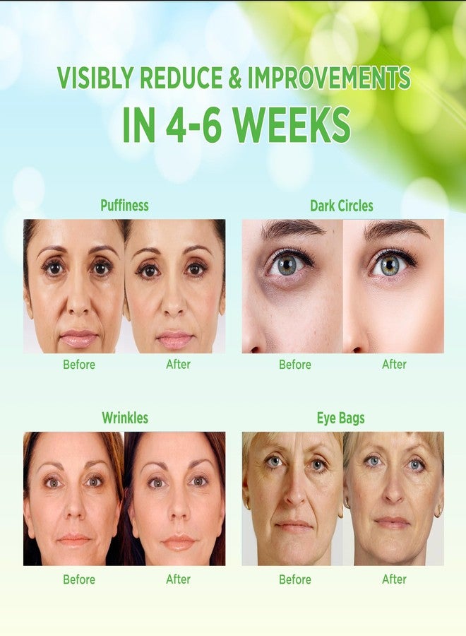 VELAMO ADVANCED Under Eye Patches: Aloe Vera Under Eye Mask for Dark Circles - Retinol Eye Patches for Wrinkles and Puffiness - Under Eye Bags Dark Circles Treatment for Women and Men 60 Pcs - Image 5